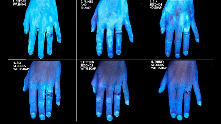 La imagen que muestra por qué lavarse correctamente las manos salva vidas